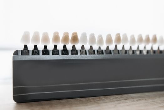 Alumina Ceramic price and cost guide - Supplier Tier and Sourcing Levers