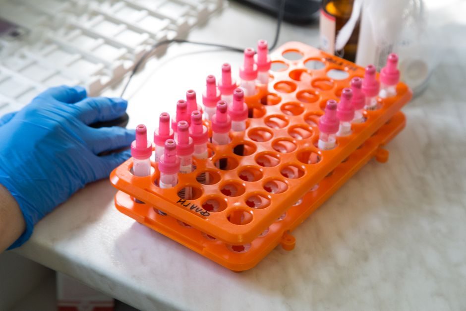 Dye Penetrant Testing Kit Buying Guide 2026: Method A/B/C, Sensitivity Tiers, and