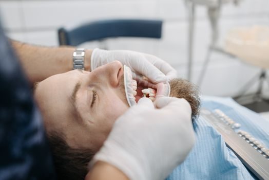 Zirconia Ceramic sizing and selection guide - Sourcing Signals and Tolerance Negotiation