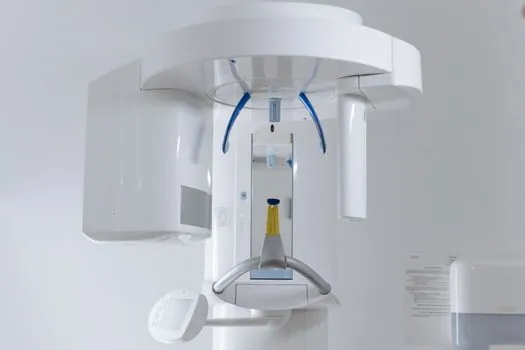 3D Scanner vs Structured Light Scanner - Side-by-Side Comparison on Four Buying Criteria
