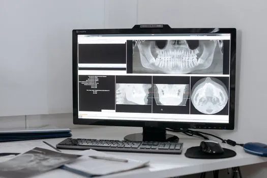 astm e94 standard guide for radiographic examination - Film vs Digital: How the Two Workflows Diverge