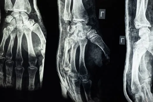 astm e94 standard guide for radiographic examination - Who Should Cite E94/E94M-22 and Who Should Not