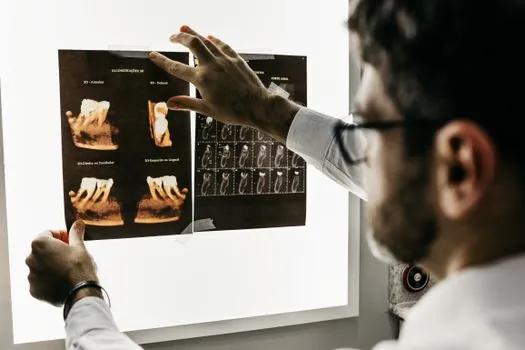 constant potential vs self-rectified industrial X-ray generator - Selection Criteria: When to Specify Each