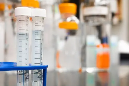 Shot Sleeve testing and commissioning procedure - Cadence: When Re-Test Is Mandatory, Not Optional