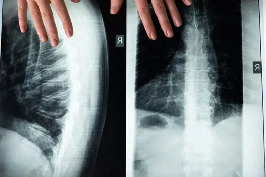 cost per exposure film vs digital radiography including chemicals - Selection Criteria: When Film Still Wins, When Digital Wins