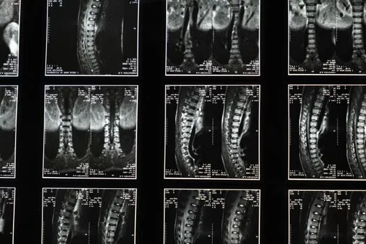 image intensifier vs flat panel detector for real-time radioscopy - What the data still cannot tell you