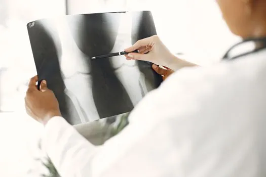 how is geometric magnification calculated in microfocus radiography? - Microfocus vs Pinhole (Pseudo-Microfocus) Geometry