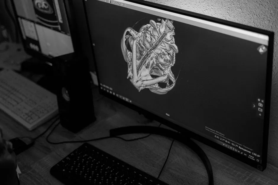 How a Flat Panel Detector Converts X-rays into a Digital Image